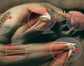 enfermedades resumaticas