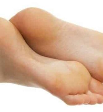 remedios caseros para curar clavos en los pies