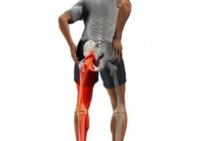 enfermedades reumaticas